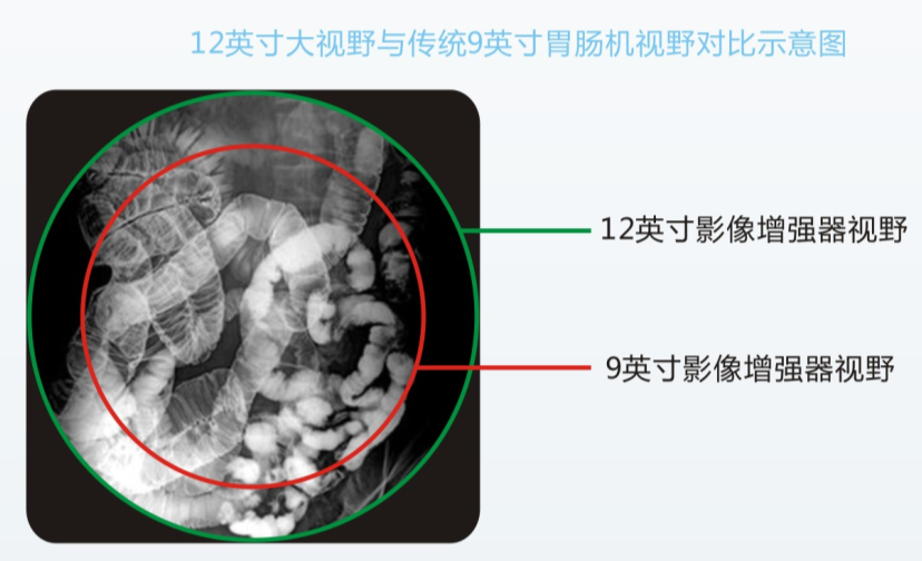 數(shù)字胃腸機(jī)優(yōu)勢與檢查效果