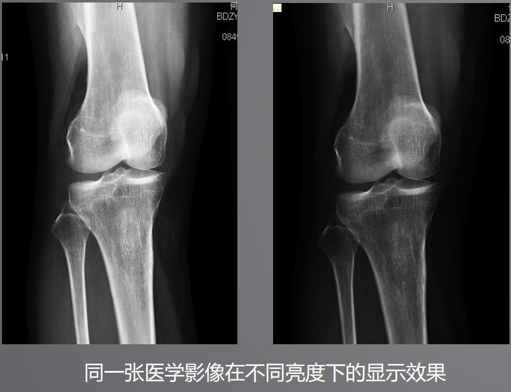 寵物DR設備的顯示器有要求？普通和醫用顯示器有什么區別