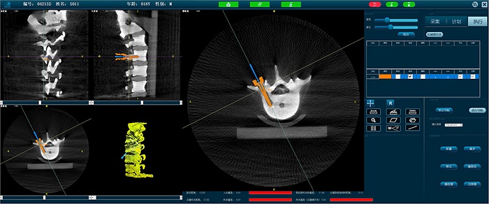 PL300B脊柱外科手術(shù)導航定位系統(tǒng)-操作界面